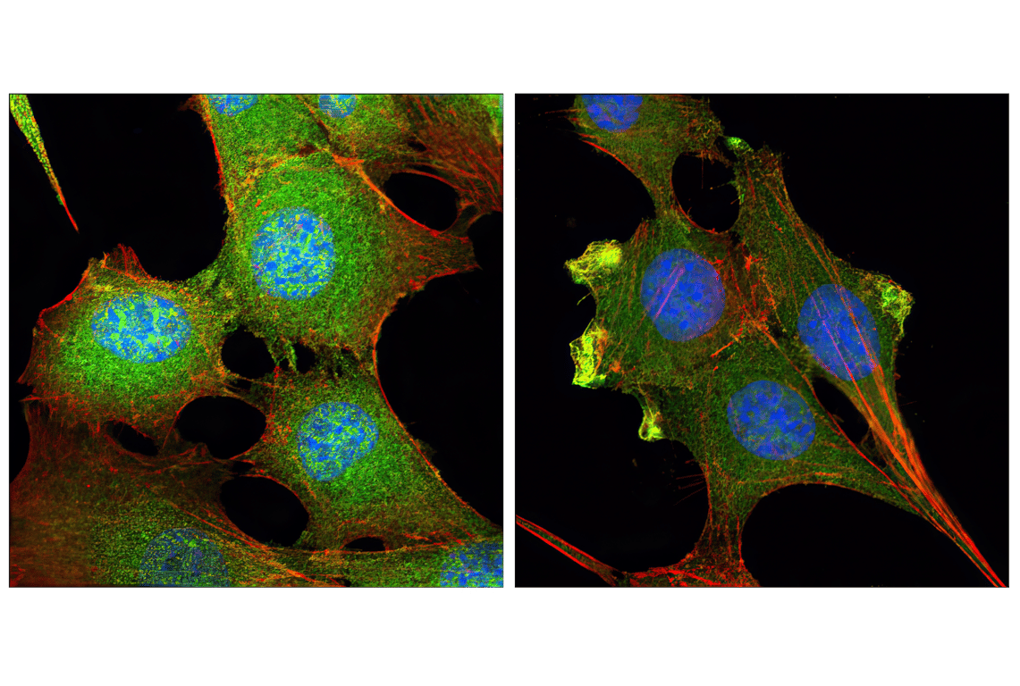 Immunofluorescence Image 1: Akt (pan) (C67E7) Rabbit Monoclonal Antibody