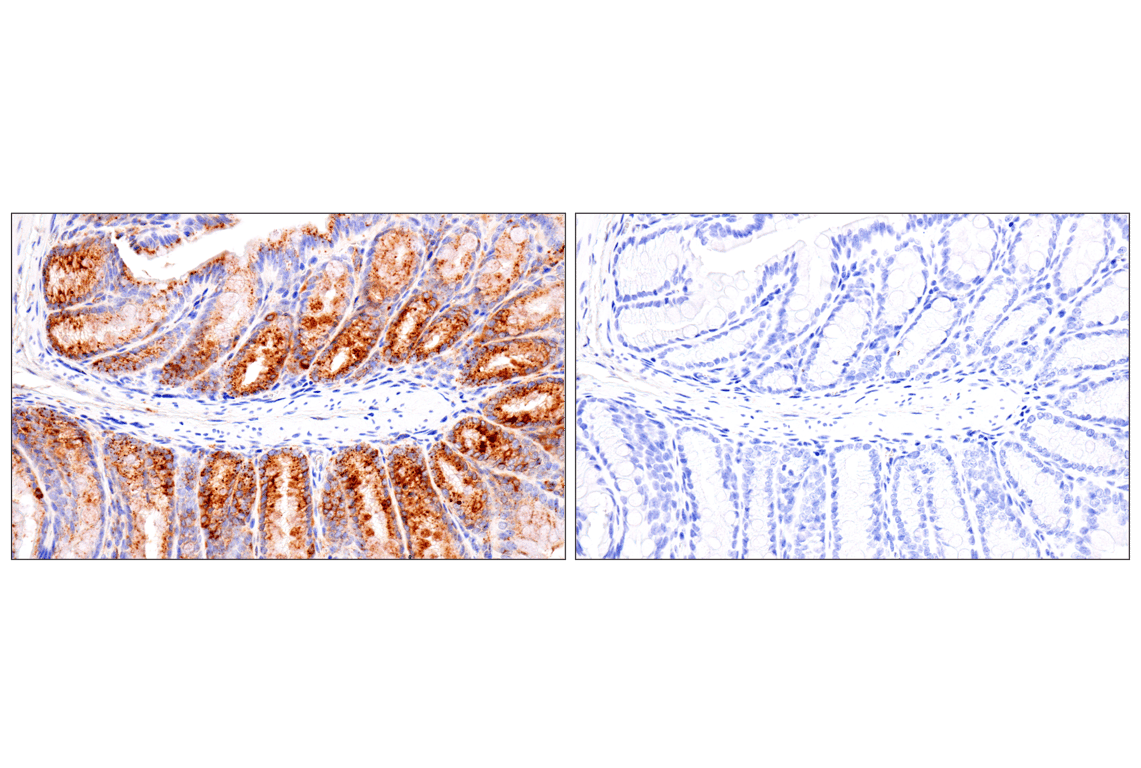 Immunohistochemistry Image 11: HEXB (E9X5S) Rabbit Monoclonal Antibody