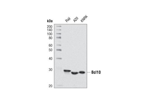 Western Blotting Image 1: Bcl10 (C78F1) Rabbit mAb