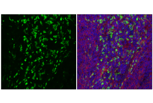 Immunofluorescence Image 2: CD68 (E3O7V) Rabbit Monoclonal Antibody (Alexa Fluor<sup>®</sup> 488 Conjugate)