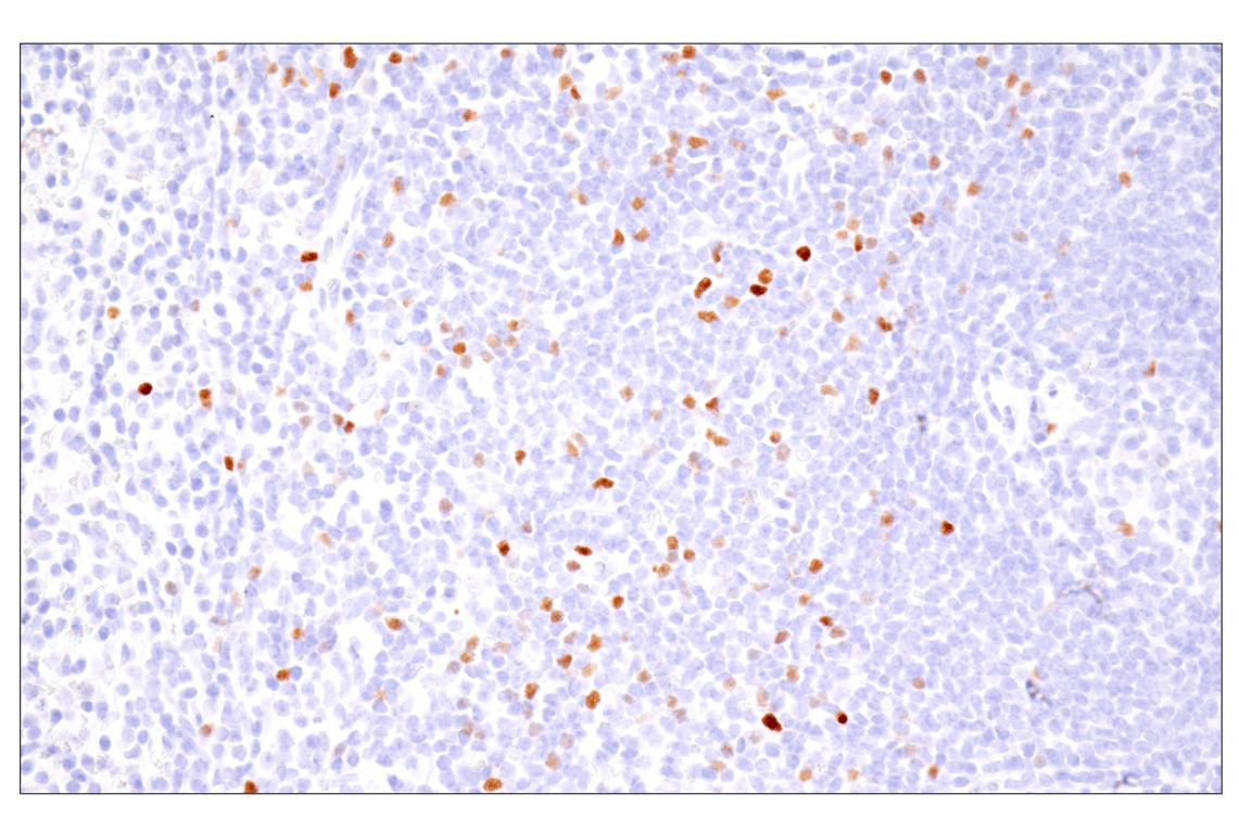 Immunohistochemistry Image 5: FoxP3 (D6O8R) Rabbit Monoclonal Antibody
