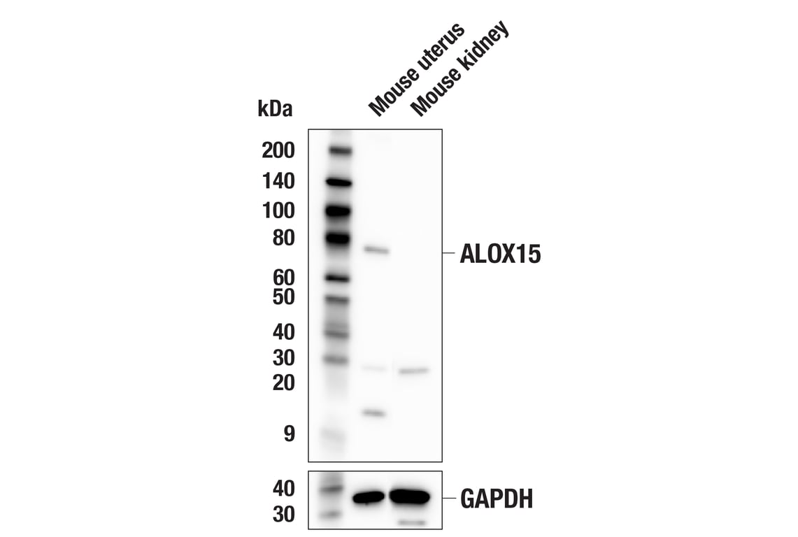 Western Blotting Image 3: ALOX15 (E5D1C) Rabbit Monoclonal Antibody