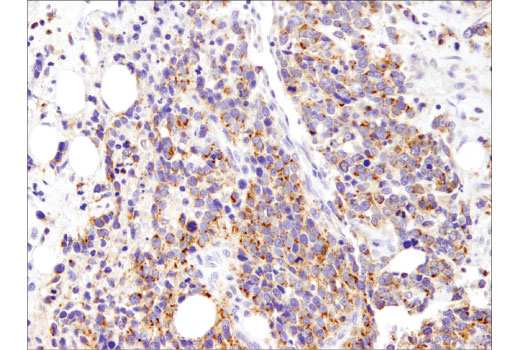 Immunohistochemistry Image 1: Mcl-1 (D5V5L) Rabbit Monoclonal Antibody (BSA and Azide Free)