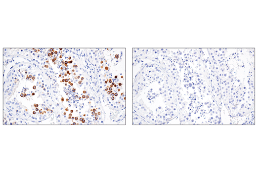 Immunohistochemistry Image 2: RHAMM/CD168 (E7S4Y) Rabbit Monoclonal Antibody (BSA and Azide Free)