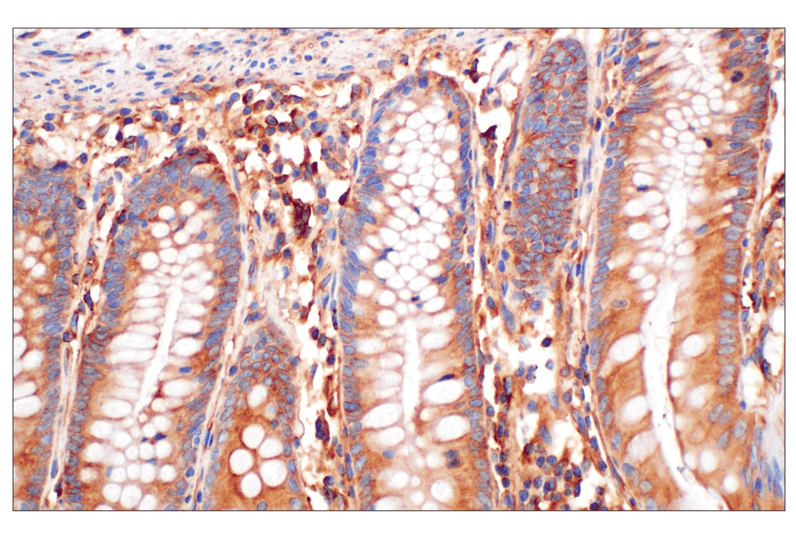 Immunohistochemistry Image 6: EEA1 (E9Q6G) Mouse Monoclonal Antibody