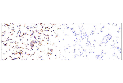 Immunohistochemistry Image 7: Fibronectin/FN1 (E5H6X) Rabbit Monoclonal Antibody (BSA and Azide Free)