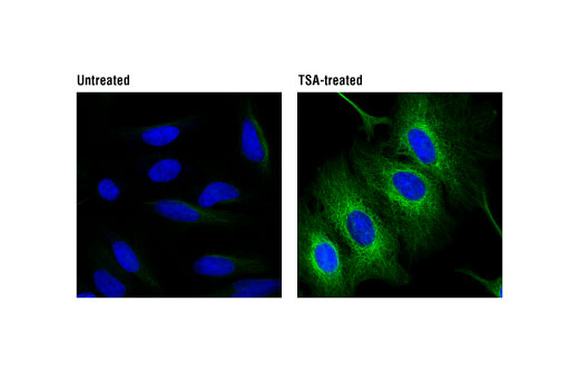 Immunofluorescence Image 1: Acetyl-α-Tubulin (Lys40) (D20G3) XP<sup>®</sup> Rabbit mAb (Alexa Fluor<sup>®</sup> 488 Conjugate)