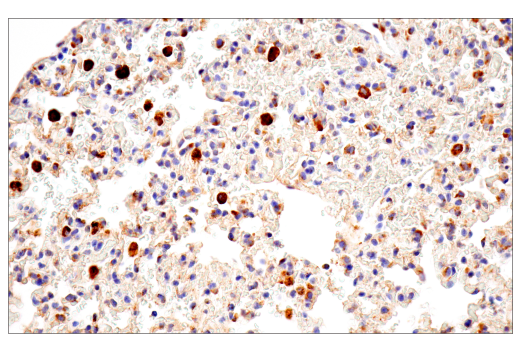 Immunohistochemistry Image 3: Cathepsin D (E7Z4L) Rabbit Monoclonal Antibody