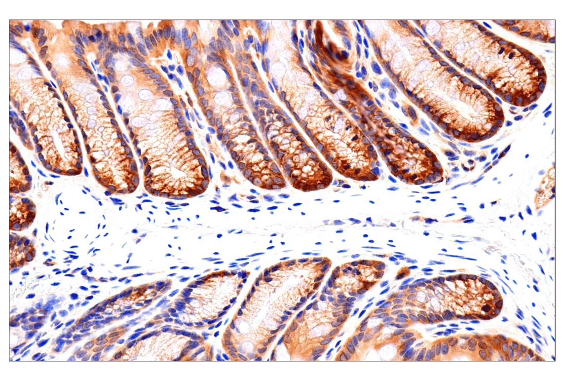 Immunohistochemistry Image 5: Caspase-8 (F5K9P) Rabbit Monoclonal Antibody (BSA and Azide Free)