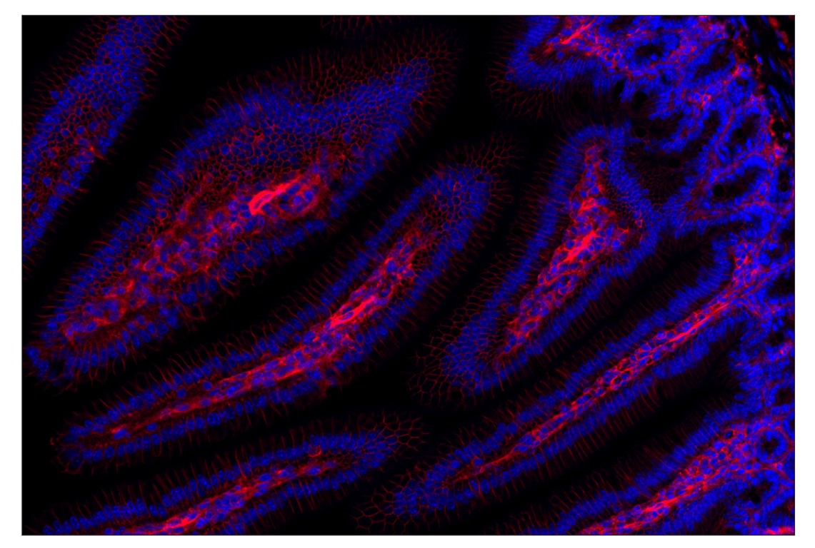 Immunohistochemistry Image 2: CD47 (E2V9V) Rabbit Monoclonal Antibody (Alexa Fluor<sup>®</sup> 555 Conjugate)