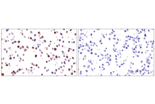 Immunohistochemistry Image 1: Factor XIIIA (E980.1) Mouse Monoclonal Antibody