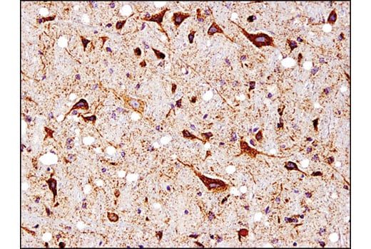 Immunohistochemistry Image 1: SOD2 (D3X8F) Rabbit Monoclonal Antibody (BSA and Azide Free)