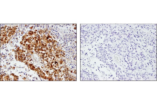 Phospho-YAP (Ser127) (D9W2I) Rabbit mAb | Cell Signaling Technology