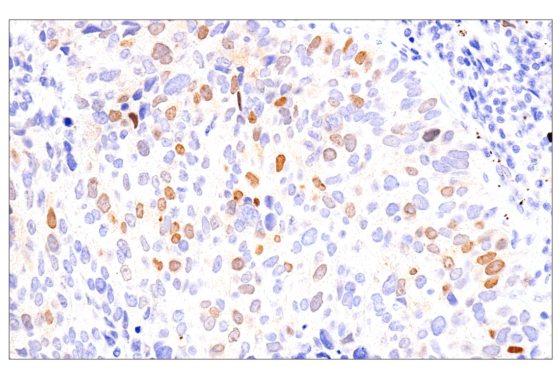 Immunohistochemistry Image 3: Chk1 (2G1D5) Mouse mAb