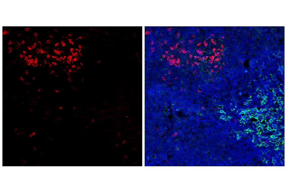 Immunofluorescence Image 2: PD-1 (Intracellular Domain) (D7D5W) Rabbit Monoclonal Antibody