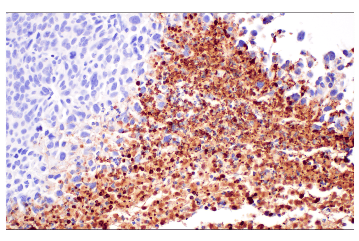 Immunohistochemistry Image 6: Citrullinated Histone H3 (Arg2) (F3C9B) Rabbit mAb (IHC Formulated)