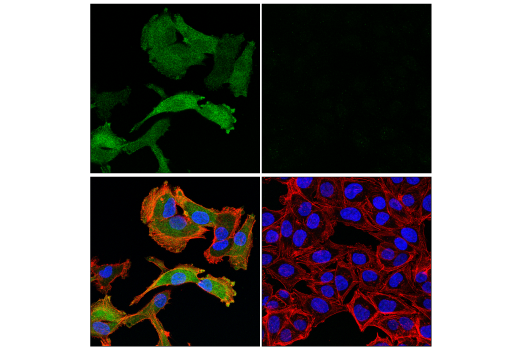 Immunofluorescence Image 1: HSP20 (E6O7A) Rabbit Monoclonal Antibody