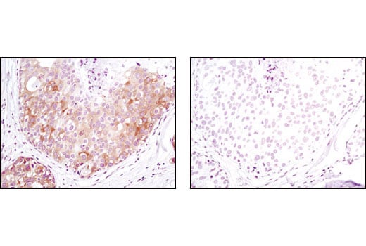 undefined Image 18: mTOR Regulation Antibody Sampler Kit