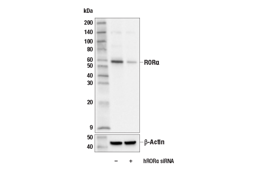Western Blotting Image 3: ROR alpha (E6G5I) Rabbit Monoclonal Antibody