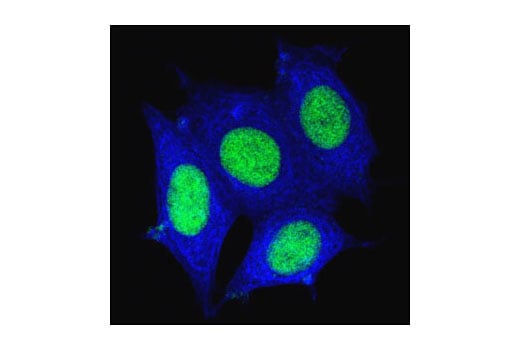 Immunofluorescence Image 1: Pan-Keratin (C11) Mouse Monoclonal Antibody (Alexa Fluor<sup>®</sup> 647 Conjugate)