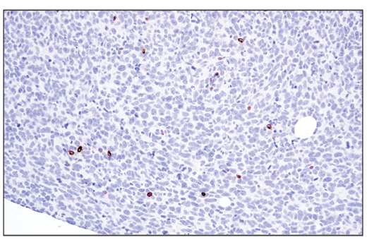 Immunohistochemistry Image 2: Perforin (E3W4I) Rabbit Monoclonal Antibody