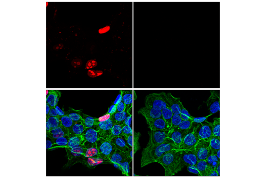 Immunofluorescence Image 1: Cre Recombinase (D7L7L) Rabbit Monoclonal Antibody (Alexa Fluor<sup>®</sup> 647 Conjugate)
