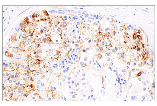 Immunohistochemistry Image 2: AFP (C3) Mouse Monoclonal Antibody