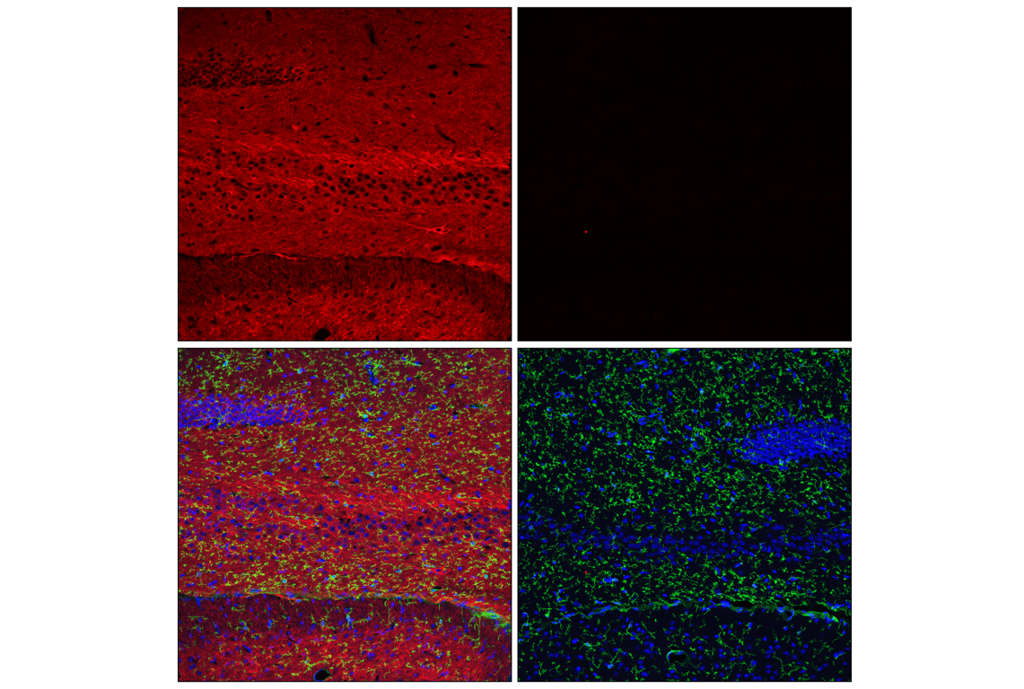 Immunofluorescence Image 1: Tau (E5G6B) Rabbit Monoclonal Antibody