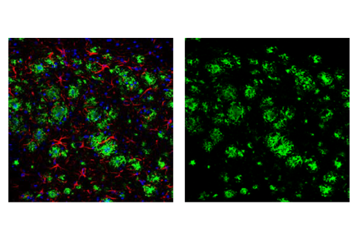 Immunofluorescence Image 1: beta-Amyloid (D54D2) Rabbit Monoclonal Antibody (BSA and Azide Free)