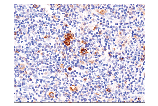 Immunohistochemistry Image 1: TNFRSF8/CD30 (E4L4I) Rabbit Monoclonal Antibody
