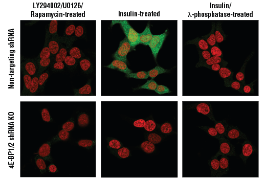 Immunofluorescence Image 1: Phospho-4E-BP1 (Thr37/46) (236B4) Rabbit Monoclonal Antibody (BSA and Azide Free)