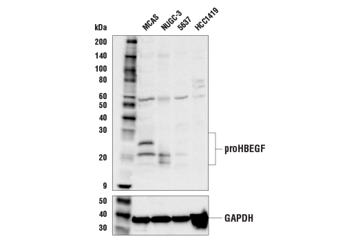 undefined Image 2: Cancer-associated Growth Factor Antibody Sampler Kit