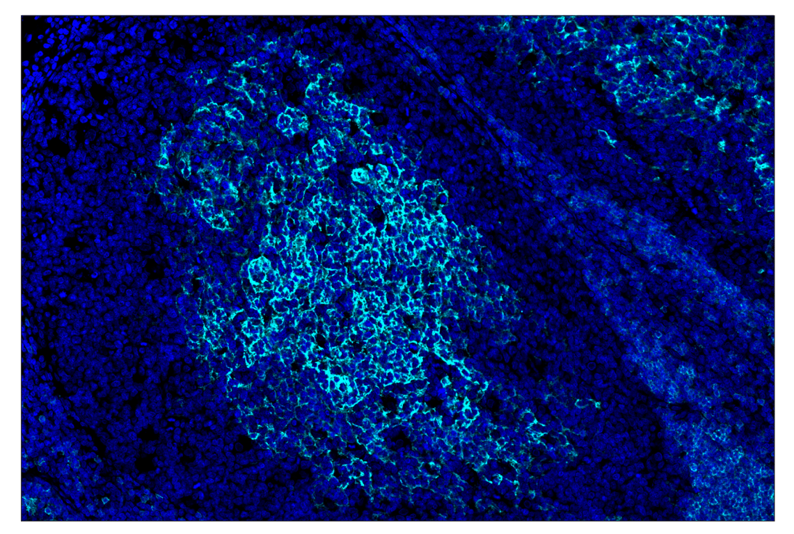 Immunohistochemistry Image 2: CD23 (E1R4G) & CO-0214-488 SignalStar<sup>®</sup> Oligo-Antibody Pair