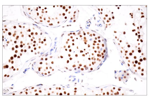 Immunohistochemistry Image 8: CPSF4 (E2L2Z) Rabbit Monoclonal Antibody