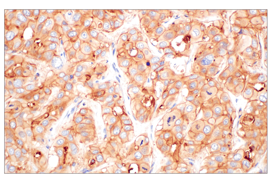 Immunohistochemistry Image 2: CD58 (F1C9B) Rabbit Monoclonal Antibody