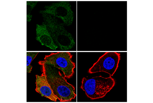 undefined Image 14: Gasdermin Family Antibody Sampler Kit