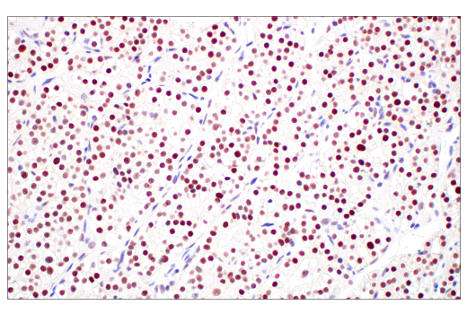 Immunohistochemistry Image 5: MLH1 (ES05) Mouse Monoclonal Antibody