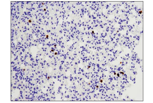 Immunohistochemistry Image 1: CD8α (D4W2Z) XP<sup>®</sup> Rabbit mAb