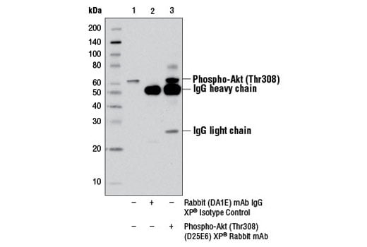 Immunoprecipitation Image 1: Phospho-Akt (Thr308) (D25E6) Rabbit Monoclonal Antibody