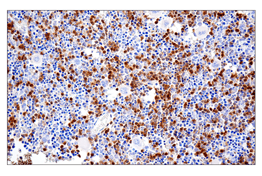 Immunohistochemistry Image 3: Ly-6G (E6Z1T) Rabbit Monoclonal Antibody