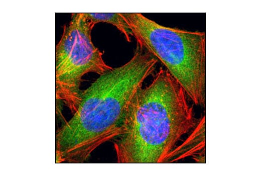 Immunofluorescence Image 1: Fatty Acid Synthase (C20G5) Rabbit Monoclonal Antibody (BSA and Azide Free)