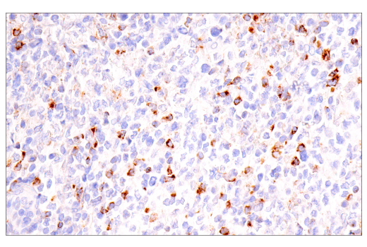 Immunohistochemistry Image 2: CTLA-4 (E2V1Z) Rabbit Monoclonal Antibody (BSA and Azide Free)