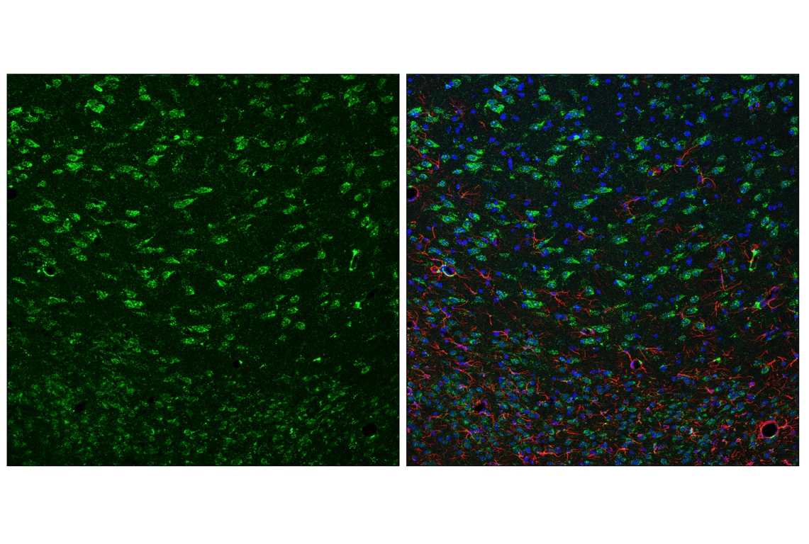 Immunofluorescence Image 3: HEXB (E9X5S) Rabbit Monoclonal Antibody
