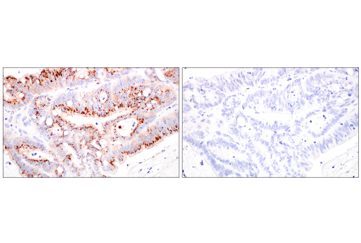 Immunohistochemistry Image 3: CD70 (E3Q1A) Rabbit Monoclonal Antibody (BSA and Azide Free)