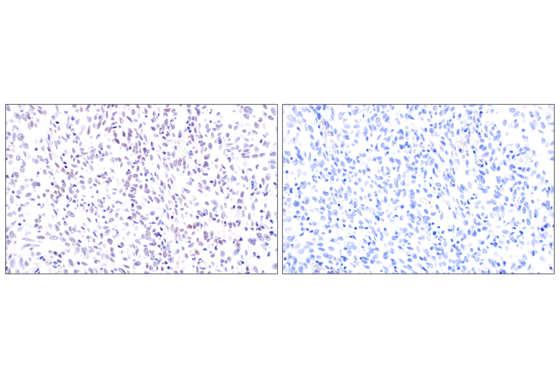 Immunohistochemistry Image 9: MDM2 (F7W7X) Rabbit Monoclonal Antibody (BSA and Azide Free)