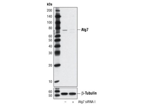 undefined Image 1: SignalSilence<sup>®</sup> Atg7 siRNA I