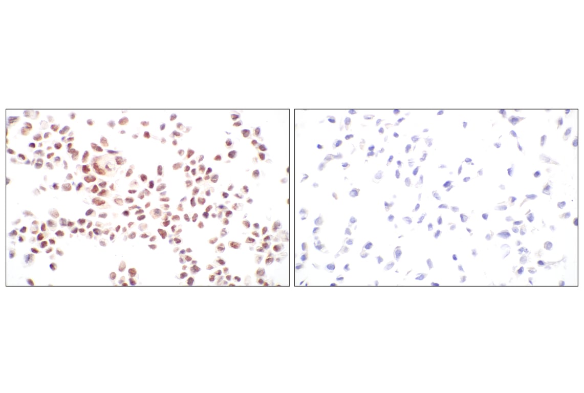 Immunohistochemistry Image 8: Menin (E5P1R) Rabbit Monoclonal Antibody