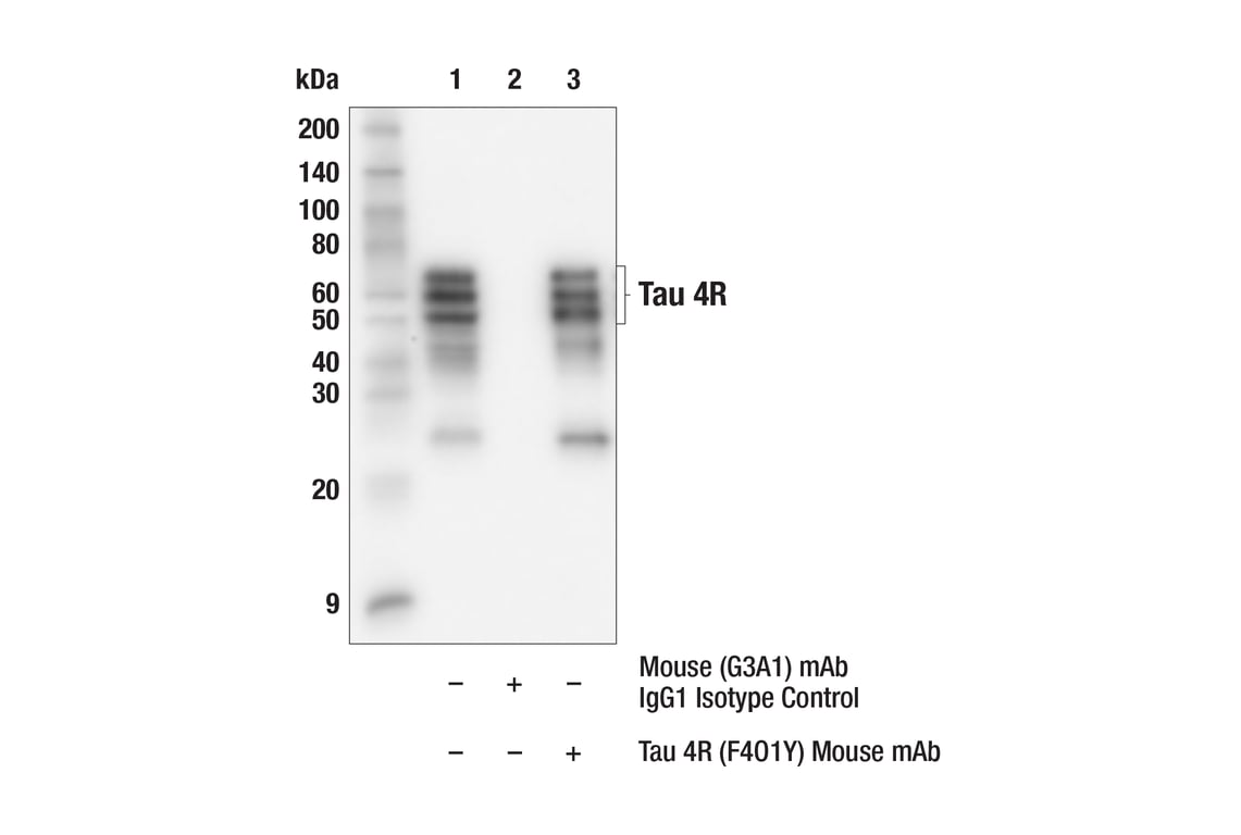 Immunoprecipitation Image 1: Tau 4R (F4O1Y) Mouse Monoclonal Antibody