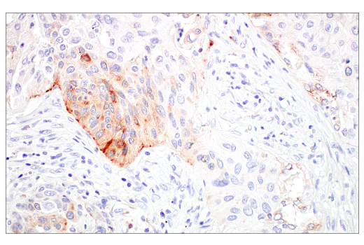 Immunohistochemistry Image 5: LAMP3/CD208 (E6E5U) Rabbit Monoclonal Antibody