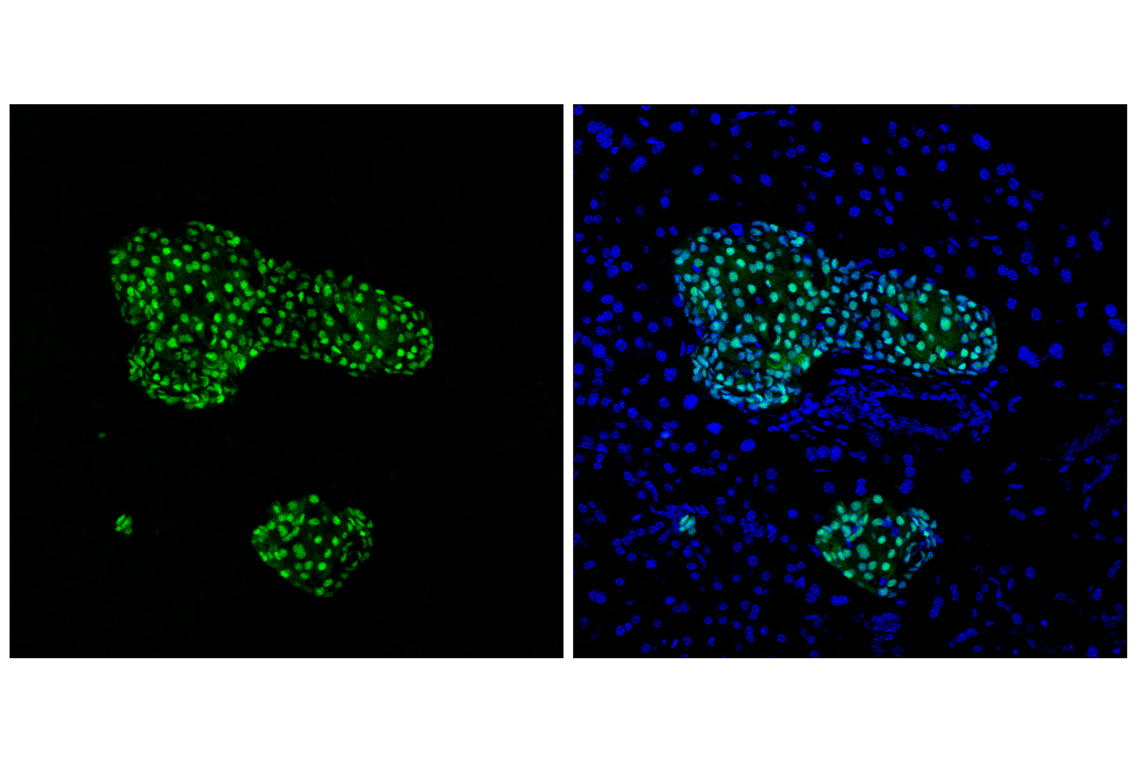 Immunofluorescence Image 1: Pax6 (D3A9V) Rabbit Monoclonal Antibody